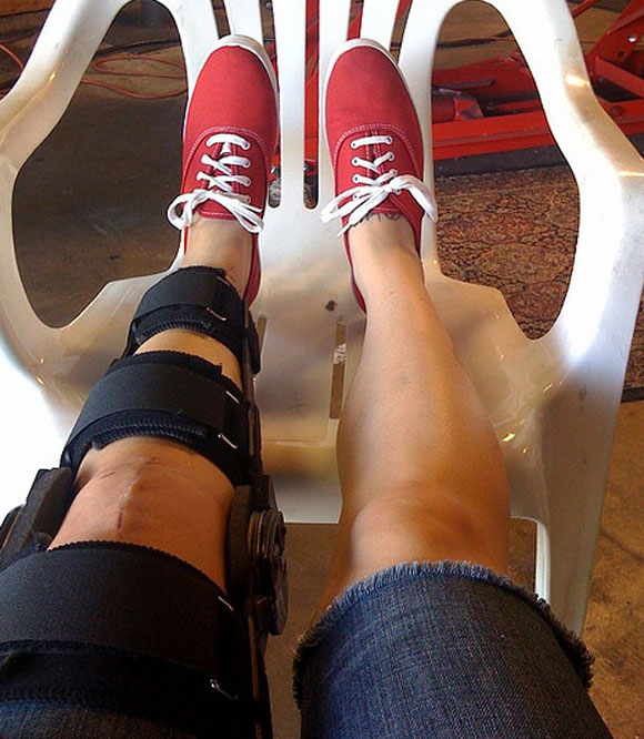 when can i get on my knees after acl surgery