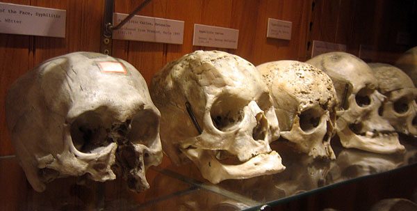 mutter-museum-adopt-skull