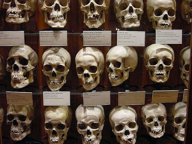 mutter-museum-skulls-wall